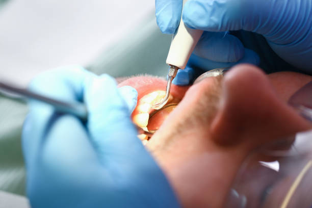 Best Emergency Dental Surgery in Tinley Park, IL