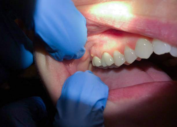 Best Emergency Treatment for Toothache in Tinley Park, IL