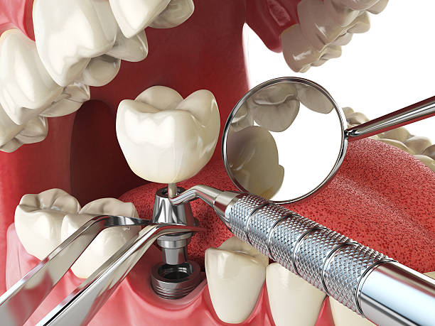 Best Emergency Dental Surgery in Tinley Park, IL